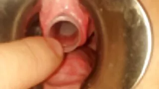 एउटा चल्ला उनको अनुहारमा कमसट छ